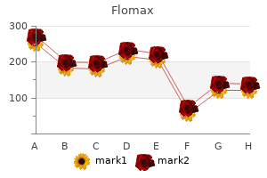 buy flomax 0.4mg with mastercard