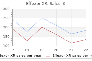 generic 75 mg effexor xr with amex